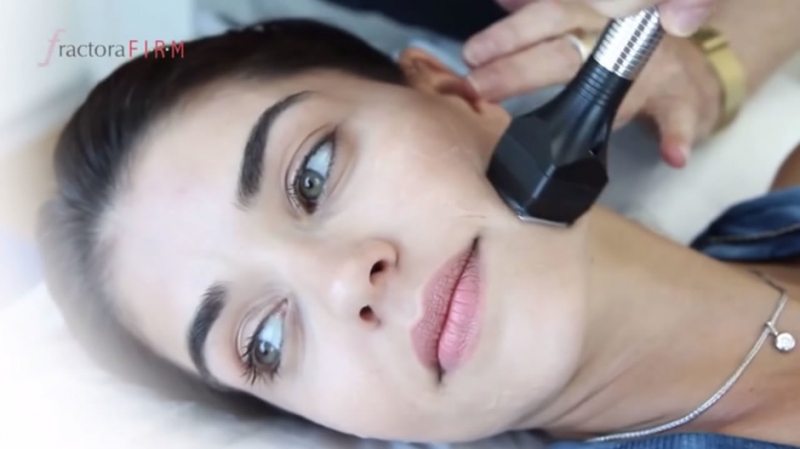 Термолифтинг Fractora firm - «Красота»