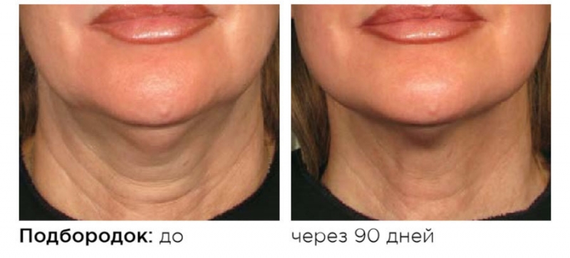 1. У Альтера-терапии множество поклонниц среди знаменитых красавиц - «Красота»