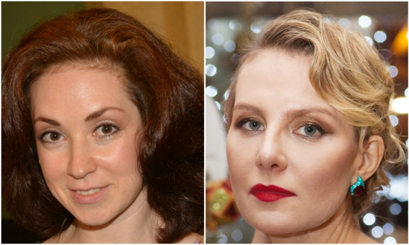 1. Что такое ботокс? - «Красота»