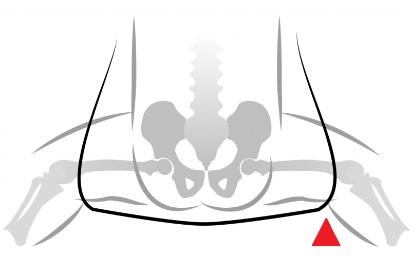 Как влияют на бедра младенцев детские автокресла, переноски, качели, ходунки и другие товары