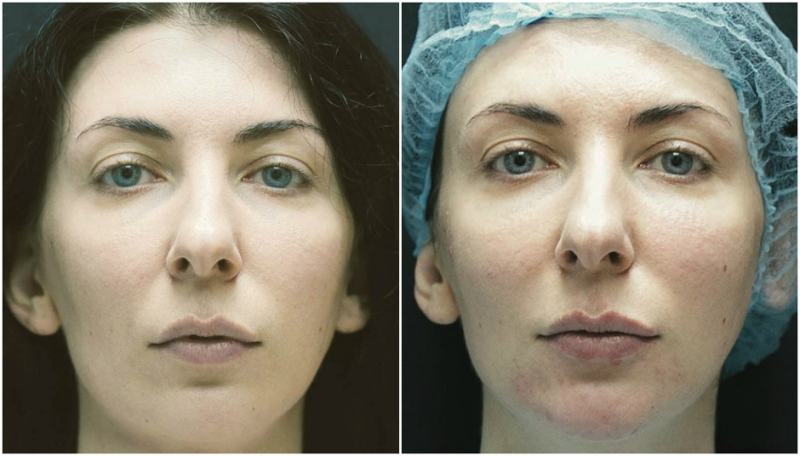 Зачем? - «Красота»