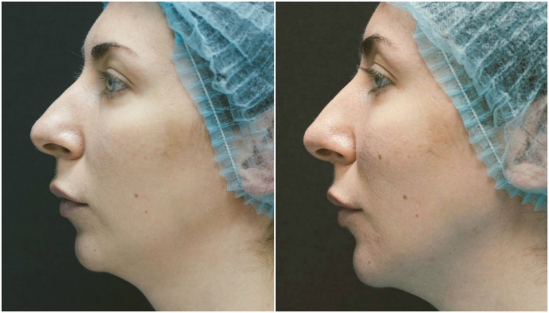 Зачем? - «Красота»