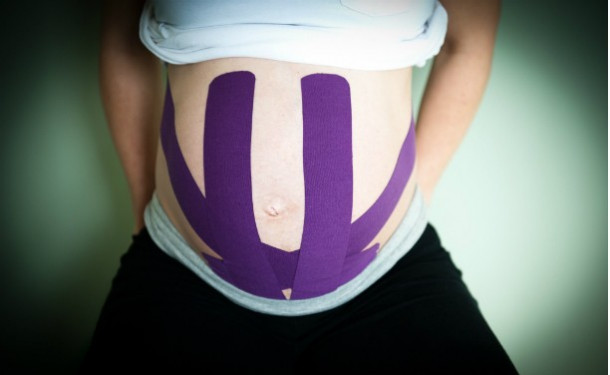 Кинезиотейпирование: может ли лента заменить бандаж для беременных - «Беременность»