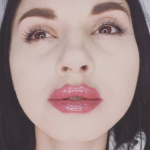 Страшно красиво! Скандальный косметолог ввел новый тренд — губы-осьминожки - «Красота»